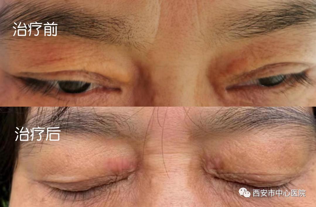 想美吗！找针灸！