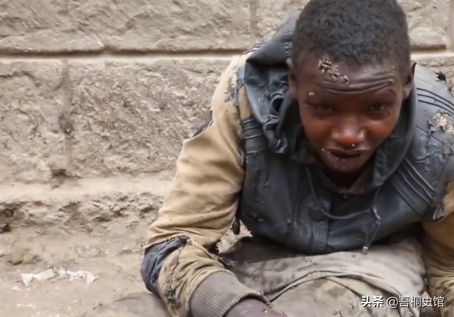 非洲男孩每天喝“胶水”，终日与蚊子相伴，被人称为“僵尸男孩”