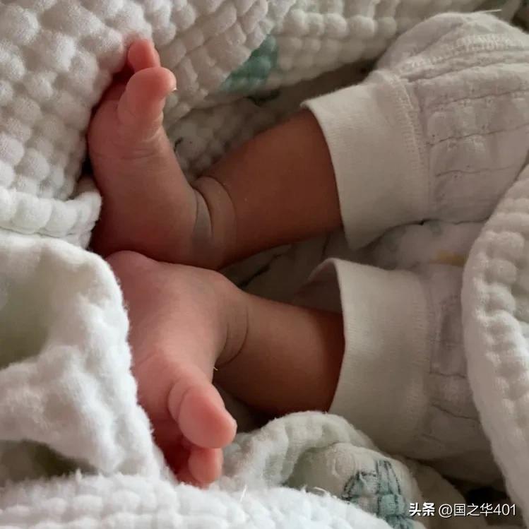 黄疸,黄疸肝炎有哪些症状