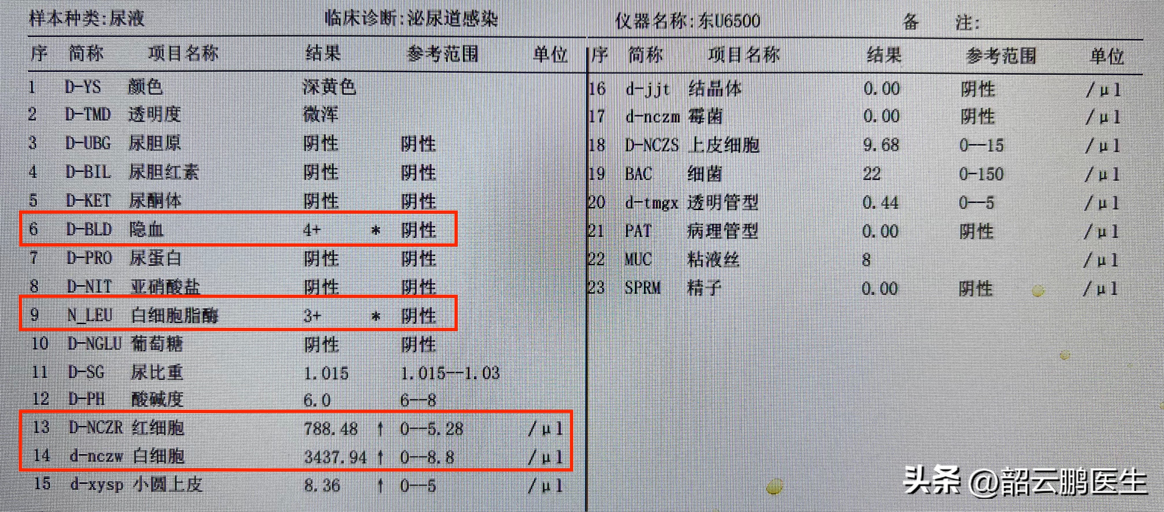 尿液有隐血可以抗凝吗,小便有血去医院检查有没有事