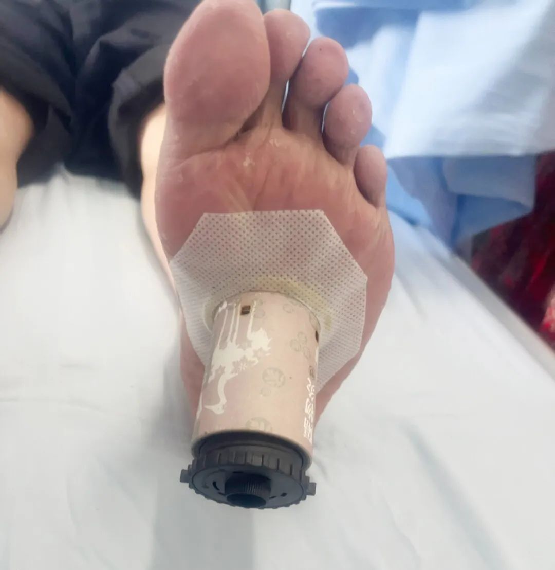 头痛失眠怎么治疗最有效,治失眠头痛有什么方法