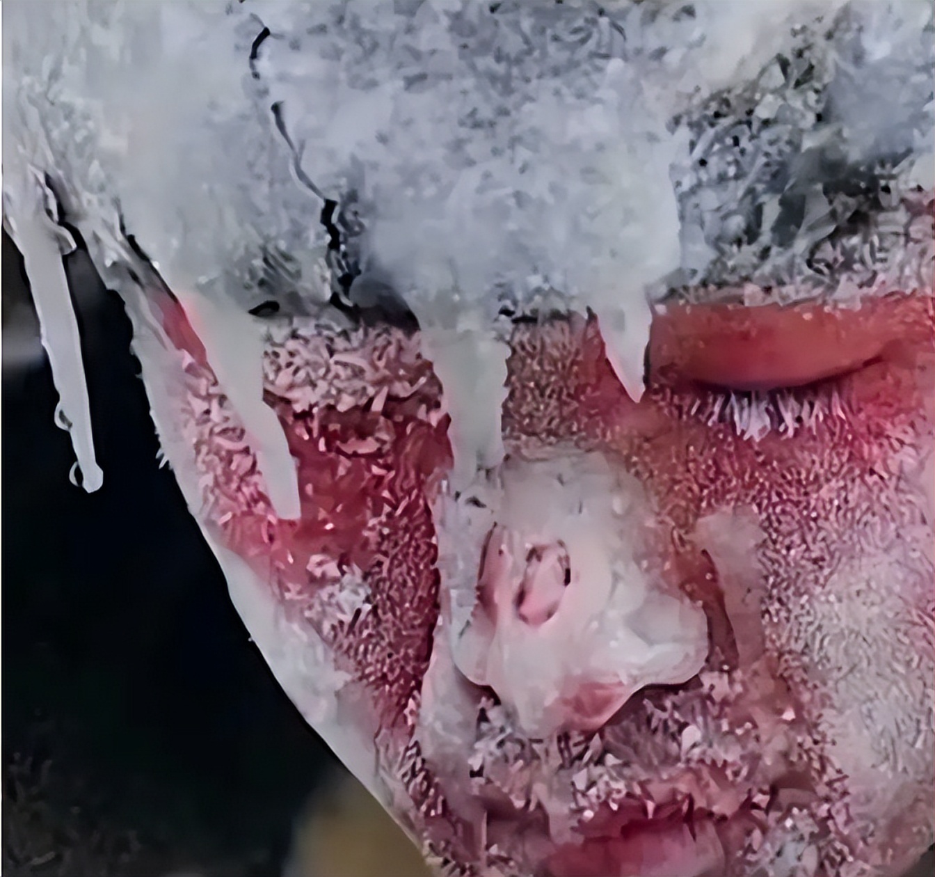 长津湖战役幸存者“朱彦夫”:失去四肢和左眼,今89岁感动中国