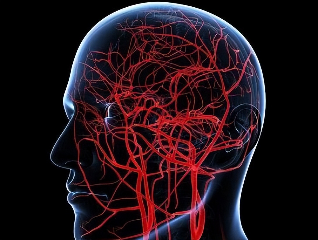 走路出现问题是不是大脑出现问题,走路跑偏脑部没问题