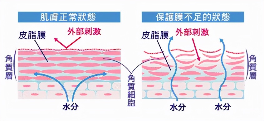 皮肤缺水会导致哪些问题,皮肤缺水会不会导致皮肤黑