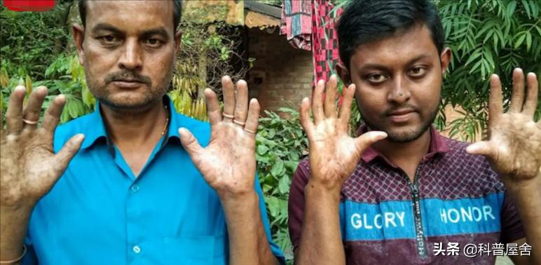 中科院发现指纹斗与簸箕的奥秘,指纹除了簸箕和斗还有一种叫什么