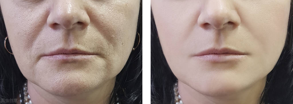 抗皱纹知识大全,抗皱纹的8种方法图片大全