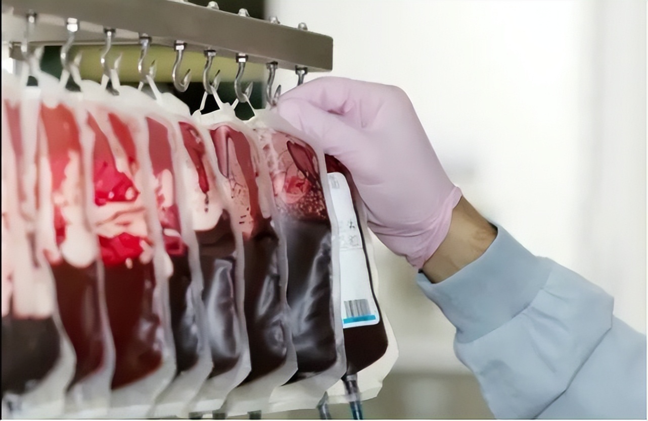 换血疗法真的能让人年轻吗,年轻人换血实验结果