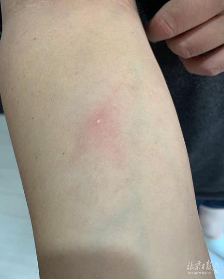 “老师，我的作业被烧了！”原因竟是……家长买这类玩具，一定要谨慎