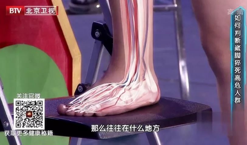 旧拖鞋千万别丢试试这个办法,预防下肢静脉血栓袜子