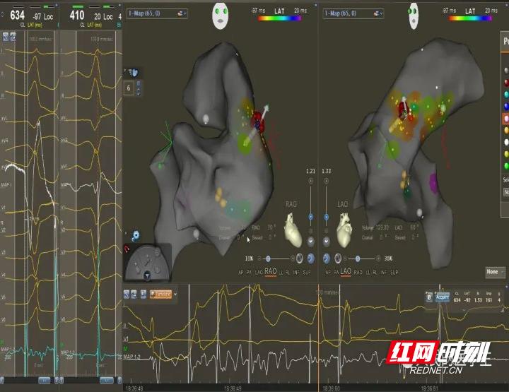 张家界医院可以做手术吗,张家界人民医院可以做激光手术吗