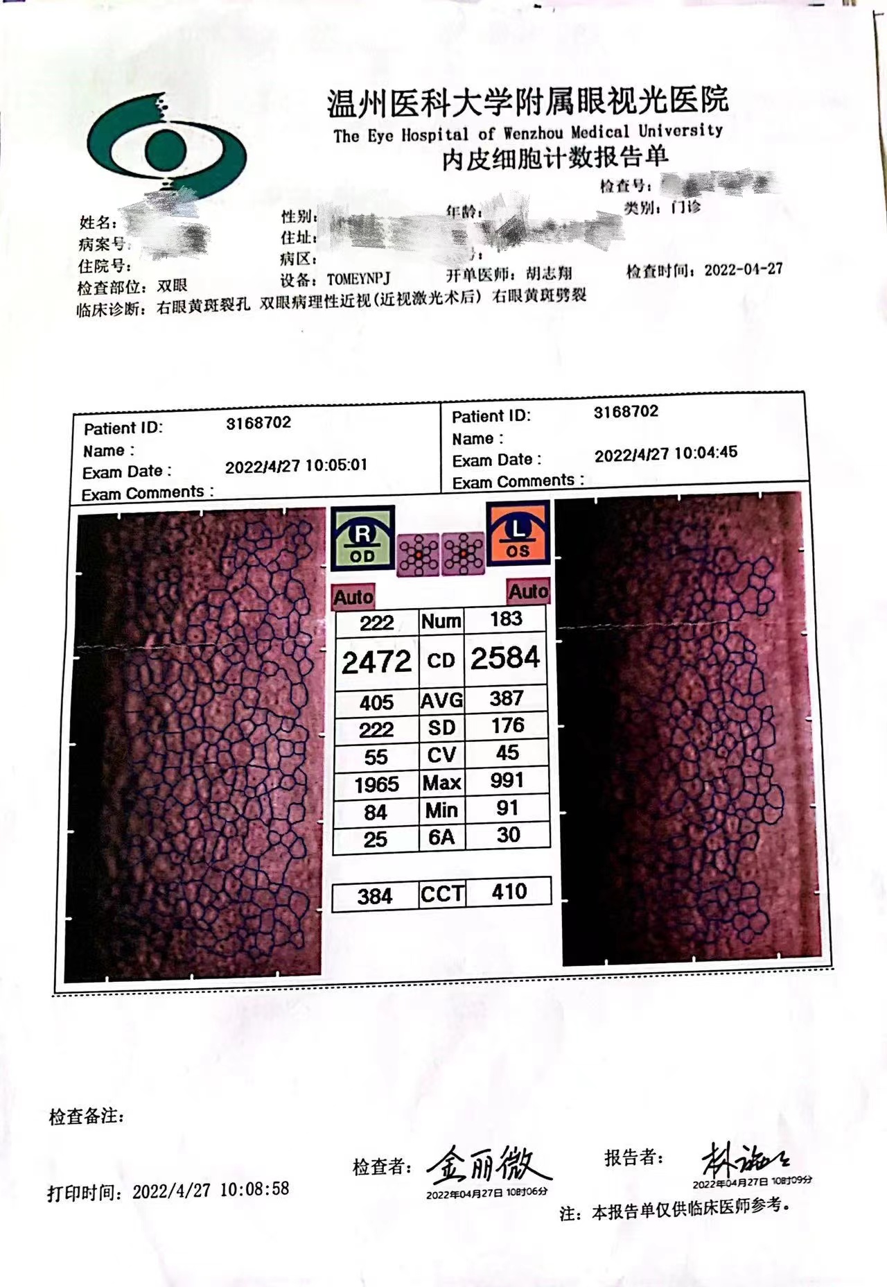 黄斑裂孔手术恢复视力几率有多大,做黄斑裂孔手术是否能引起失明