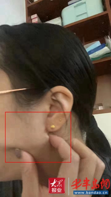 花了7万多元做整形,花了1600万整容失败