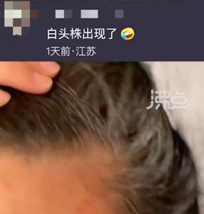 感染后头发变直了,感染后一夜白发