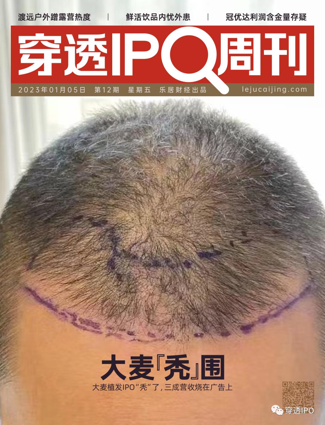 大麦植发ceo,大麦植发的最新广告