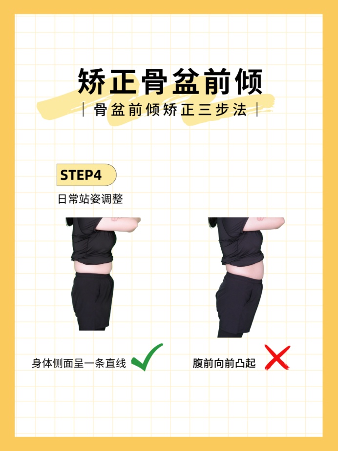 生娃两年后可以做盆底康复么,生娃后什么时候可以做康复训练