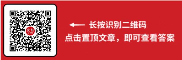 治疗白癜风，激素如何调整？又有哪些新进展？一文总结！