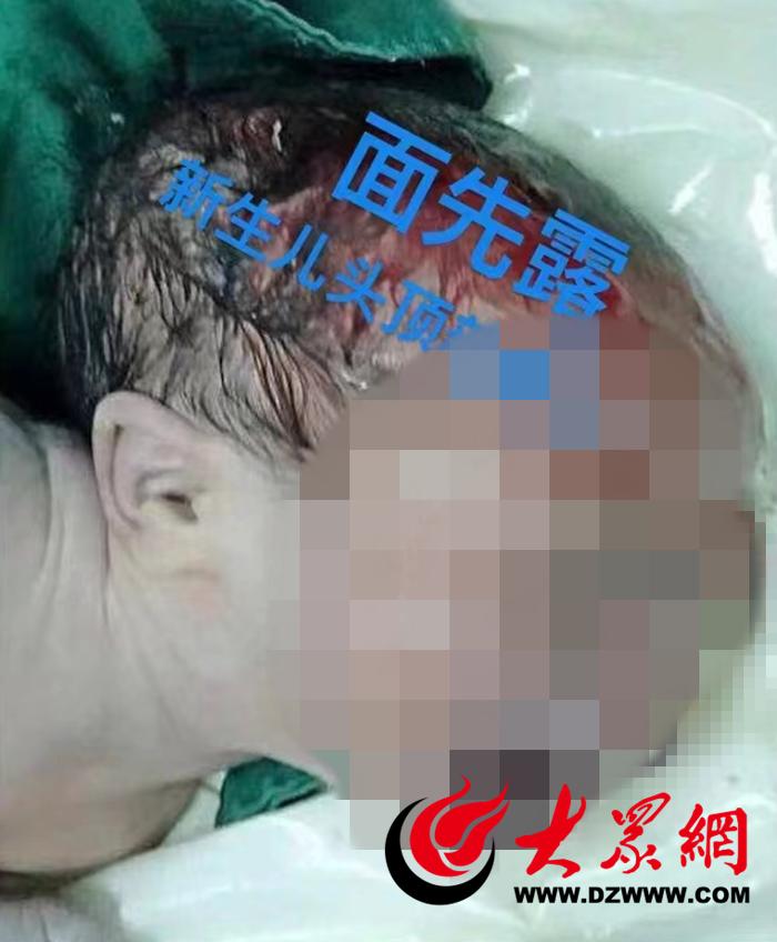 分娩过程中出血怎么回事,为什么分娩时脸会发麻